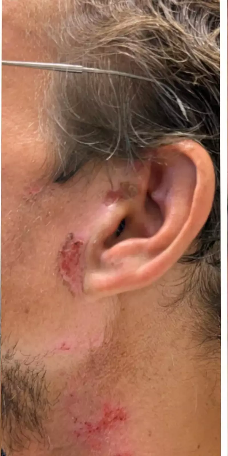 This is my head in 2024 at start of decontamination through AIBCPS project at Reactwell to reverse engineer China PLA MSS Xi Magic Weapon.